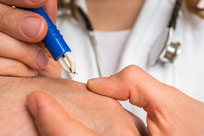 Chronic Lyme Disease in Bloomington, MN