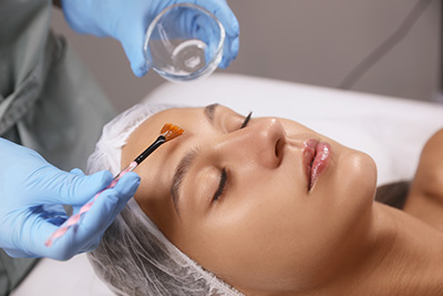 Winter Chemical Peels in Bloomington MN: Enlighten & BioRePeel